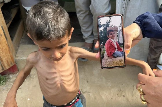 বোমা ও ত্রাণ-অবরোধের মধ্যে গাজার শিশুরা বেঁচে থাকার সংগ্রাম করছে
