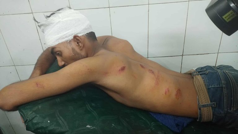 যুব দল নেতার নেতৃত্বে ছুরিকাঘাতে গুরুতর আহত জামায়াত কর্মী